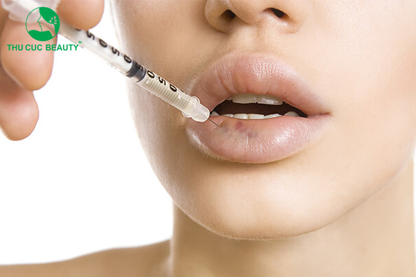 Các dấu hiệu cảnh báo cần tiêm tan filler ngay 1 Các dấu hiệu cảnh báo cần tiêm tan filler