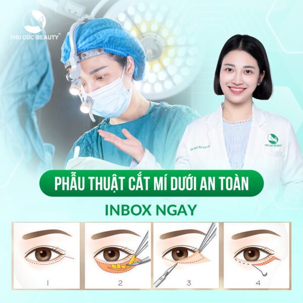 cat bong mat duoi to e1776943674616