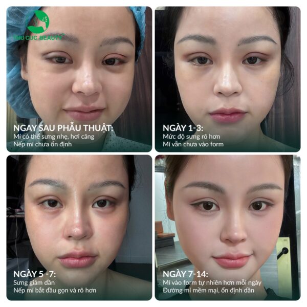 cat mi bao lau thi dep e1776338523302