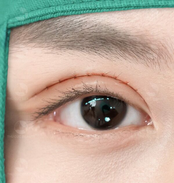 cat mi mat lan 2 e1777023442687