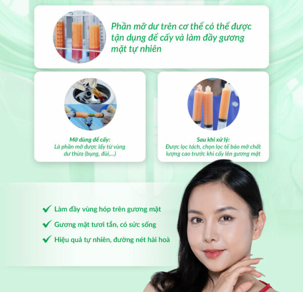 Cấy mỡ thái dương giữ được bao lâu?