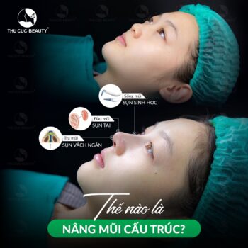 Giá nâng mũi cấu trúc bao nhiêu tiền?