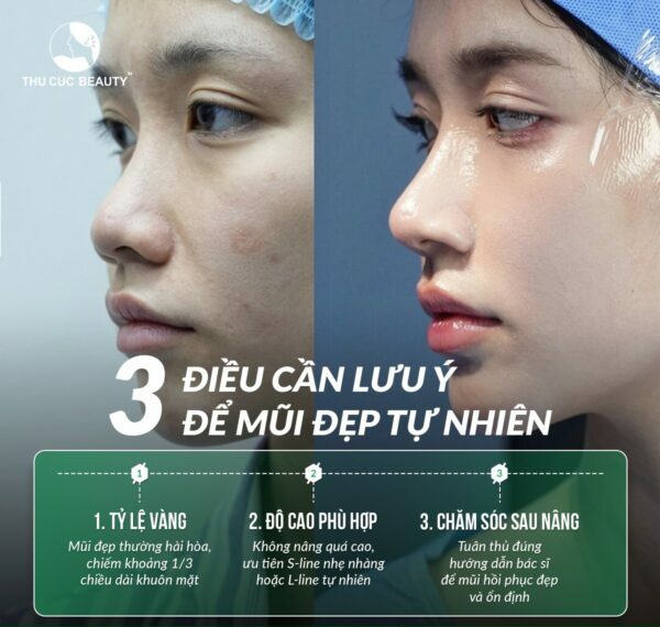 gia nang mui cau truc e1776846537408