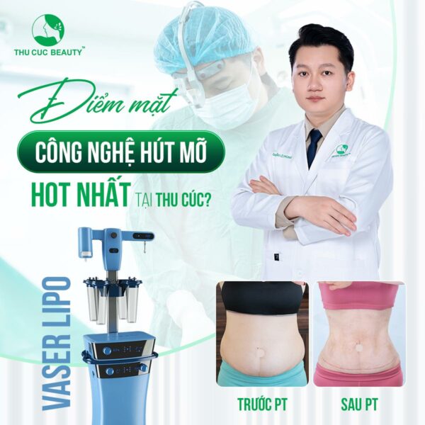 hut mo tao hinh e1776769471659