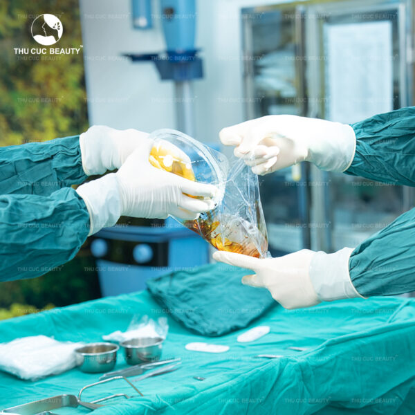 Nâng ngực không chạm hạn chế tối đa tình trạng nhiễm trùng, bao xơ ngực.