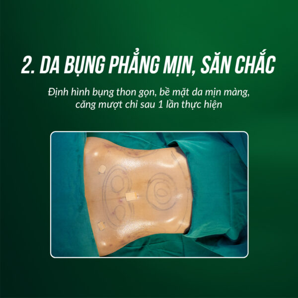tao hinh thanh bung e1776769551303