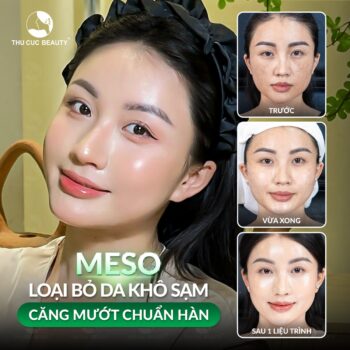 Tiêm meso kiêng ăn gì để nhanh đẹp da?