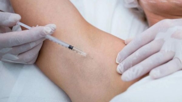 Quy trình tiêm botox nách trị tăng tiết mồ hôi diễn ra nhanh chóng.