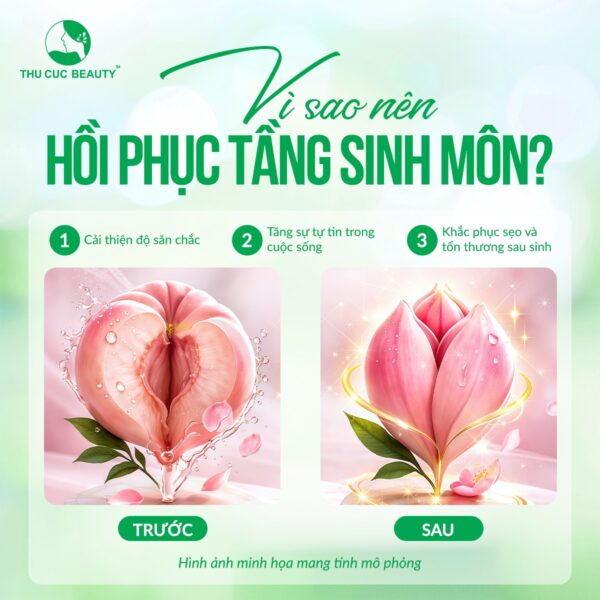 vi sao nen tham my tang sinh mon e1776681768748