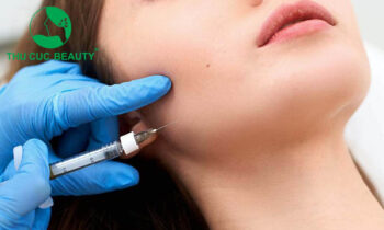 Các biểu hiện sau khi tiêm Botox gọn hàm cần biết