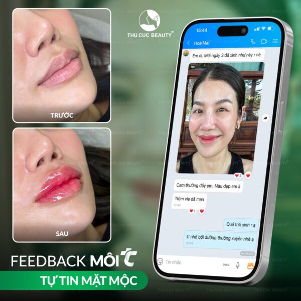 Địa chỉ cấy môi sinh học đẹp, uy tín