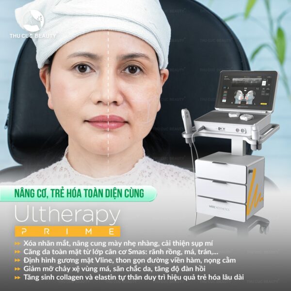 cong nghe ultherapy la gi e1777893951131
