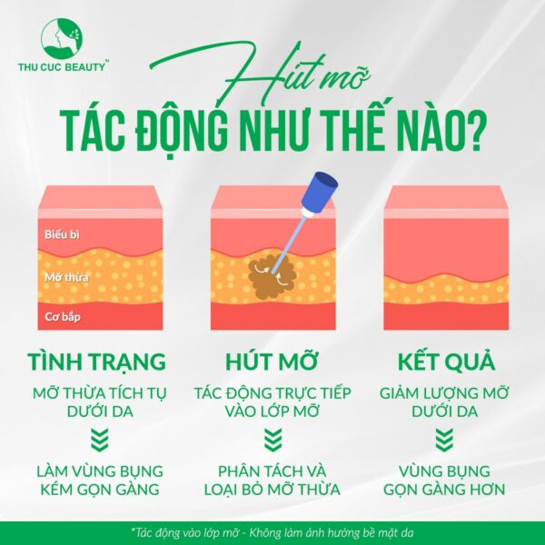 cong nghe ultra sound x e1778757811239