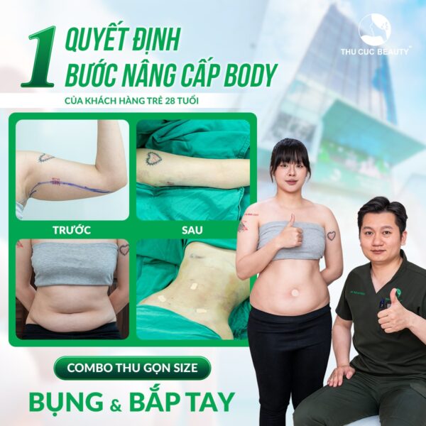 Hút mỡ bụng ở đâu an toàn Hà Nội? Gợi ý địa chỉ uy tín, hiệu quả 5 hut mo bung thu cuc e1780025112508