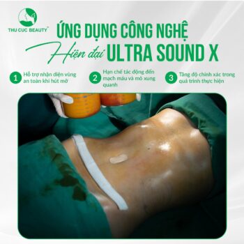 Hút mỡ công nghệ Ultra Sound X là gì?