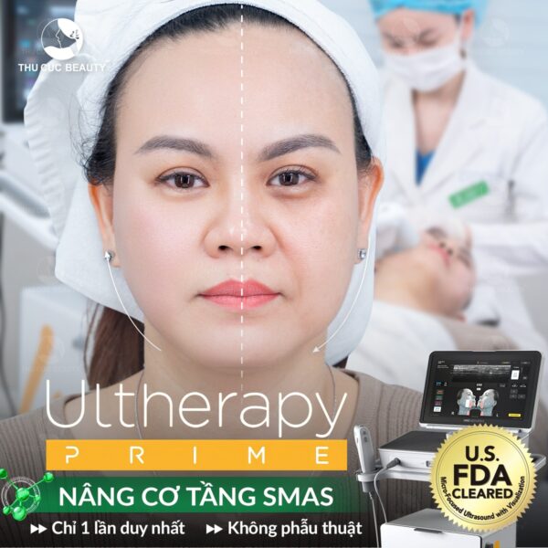 Nâng cơ hiệu quả bằng Ultherapy