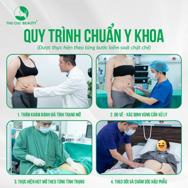 quy trinh hut mo e1778757854801
