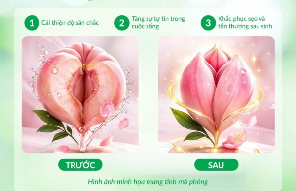 Thẩm mỹ cô bé bao nhiêu tiền? Làm ở đâu an toàn, uy tín?