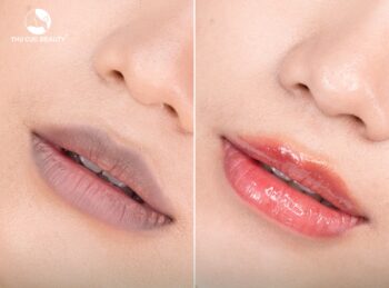 Trị môi thâm có được vĩnh viễn không?