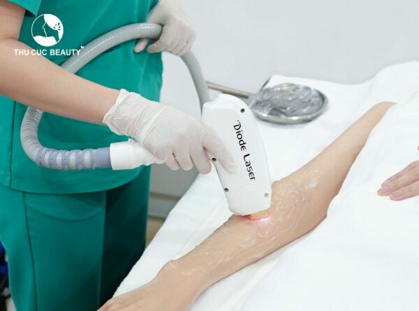 Triệt lông có đau không phụ thuộc vào công nghệ máy móc, tay nghề kỹ thuật viên.