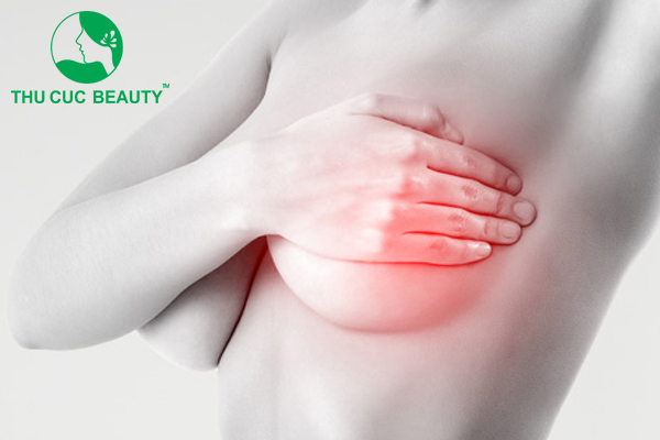 Bao xơ ngực có nguy hiểm không?