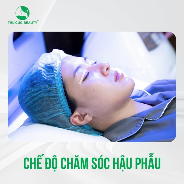 cham soc mi de tranh seo loi e1781608859709