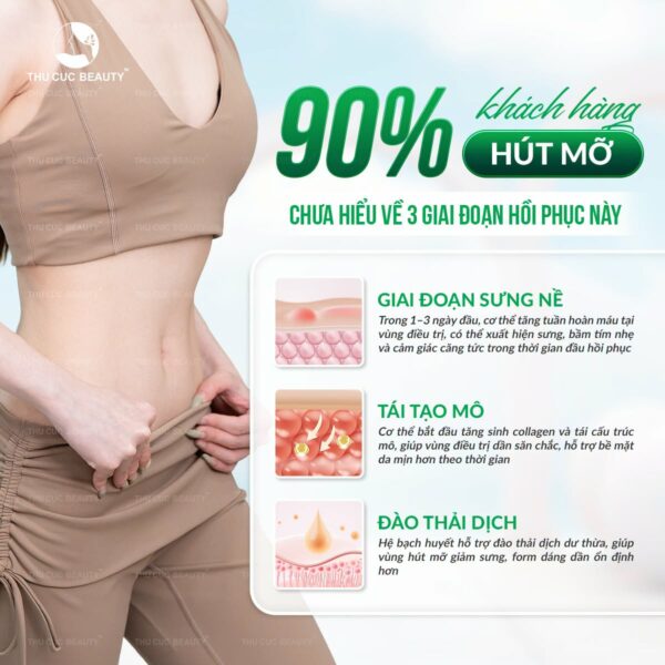 Điều cần biết khi hút mỡ bụng
