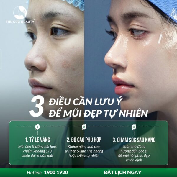gia nang mui cau truc e1782123634567