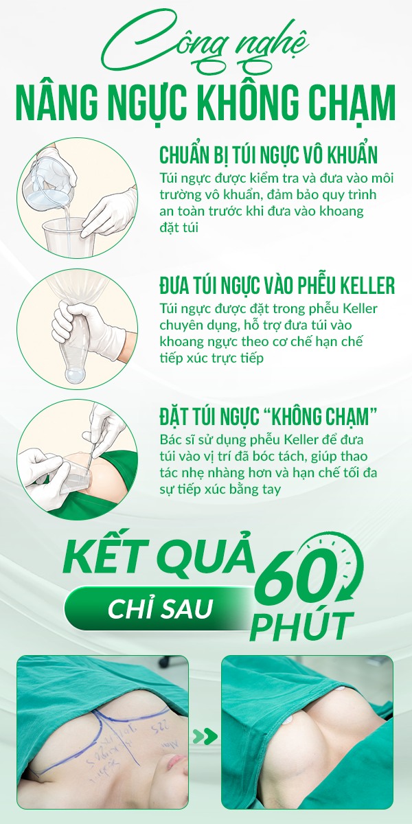 Bao xơ ngực có nguy hiểm không? 3 Nâng ngực không chạm giúp giảm tỉ lệ bị bao xơ ngực.