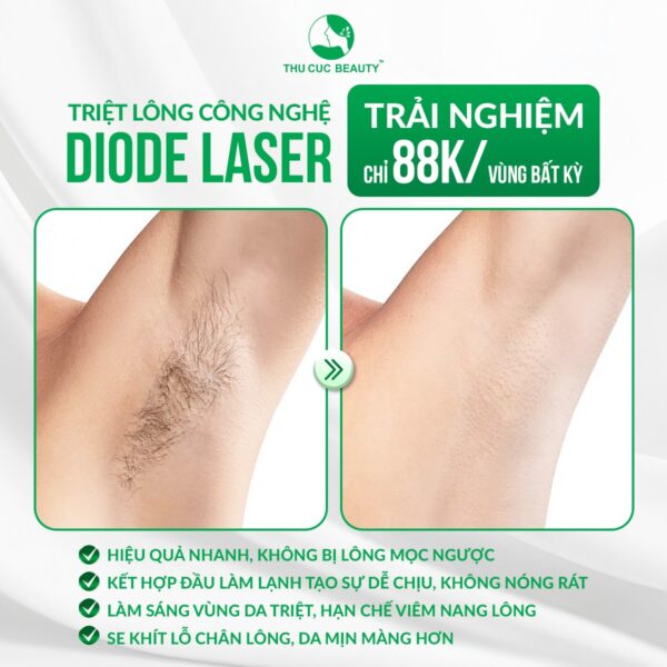 triet long vinh vien e1780483994972